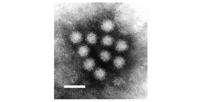 ノロウイルスが猛威を振るう　患者数が10年ぶりの多さ