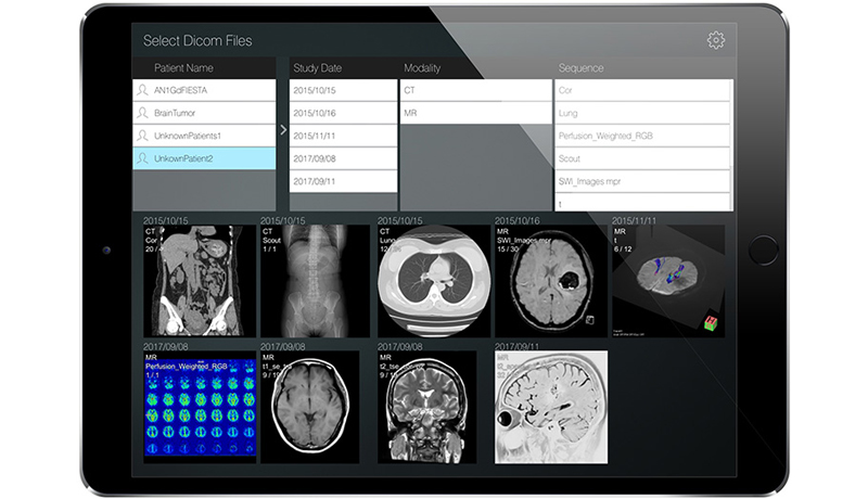 CTやMRIなど医用画像が見られる無料アプリ開発