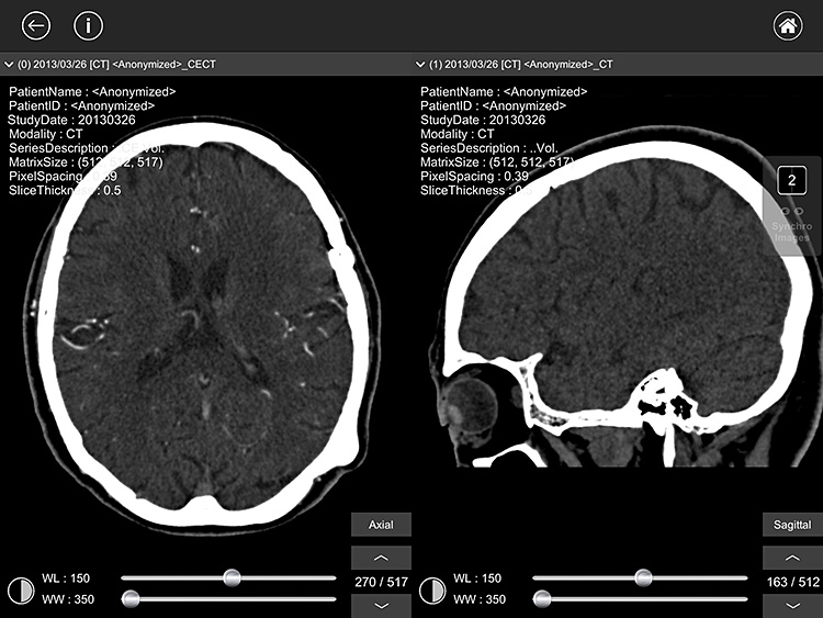 CTやMRIなど医用画像が見られる無料アプリ開発