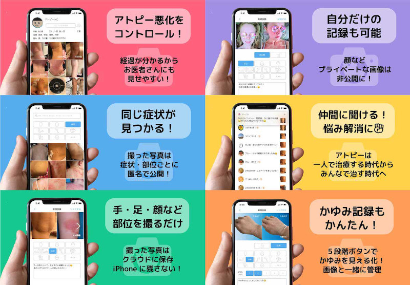 アトピー見える化アプリ「アトピヨ」が「異能vation 2020」特別賞を受賞